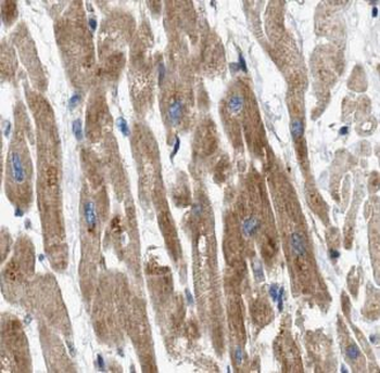 TYR Rabbit Polyclonal Antibody