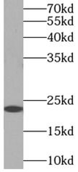 MYL3 Rabbit Polyclonal Antibody