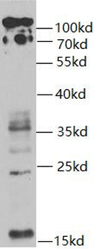 UBB Rabbit Polyclonal Antibody