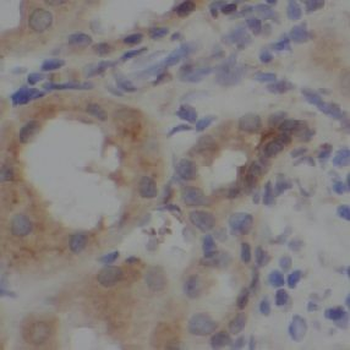 UBB Rabbit Polyclonal Antibody
