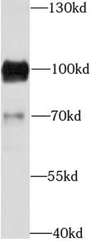 CD19 Rabbit Polyclonal Antibody