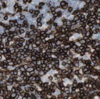 CD19 Rabbit Polyclonal Antibody