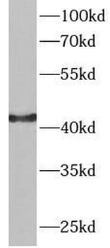 GOT1 Rabbit Polyclonal Antibody