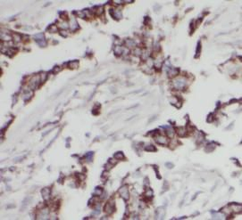 GOT1 Rabbit Polyclonal Antibody