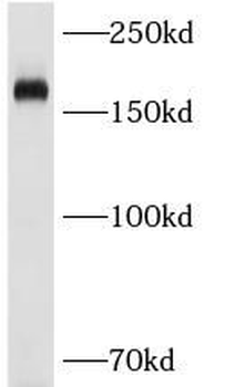 CD206 Rabbit Polyclonal Antibody