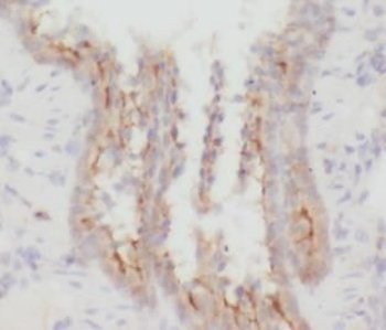 CD206 Rabbit Polyclonal Antibody