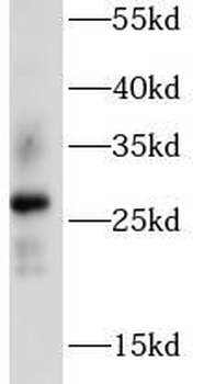 AQP2 Rabbit Polyclonal Antibody