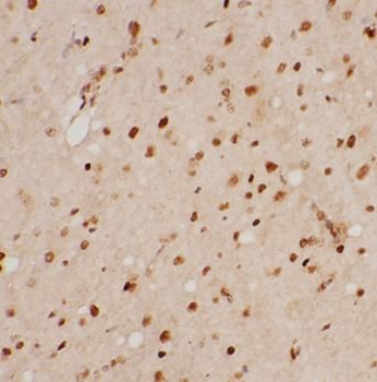 Melatonin Antibody