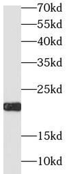 IGF1 Rabbit Polyclonal Antibody