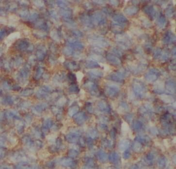 IGF1 Rabbit Polyclonal Antibody