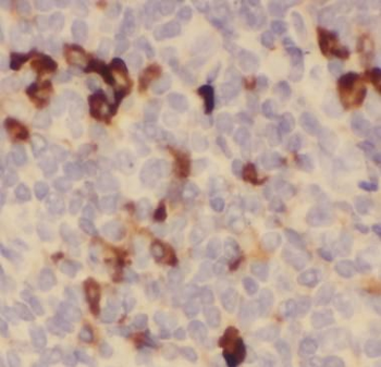 CTLA4 Rabbit Polyclonal Antibody