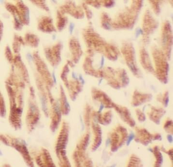 ATP5F1B Mouse Monoclonal Antibody