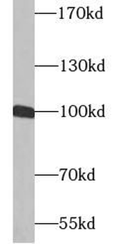 VCAM1 Mouse Monoclonal Antibody