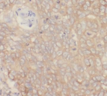 VCAM1 Mouse Monoclonal Antibody