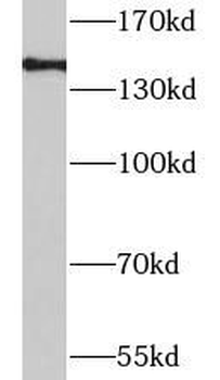 LRIG1 Antibody