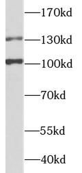 ZEB2 Antibody
