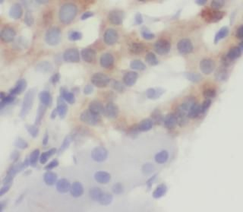 CCK Antibody