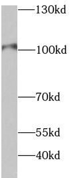 HK2 Antibody