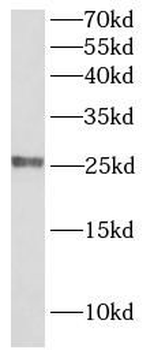CLDN5 Rabbit Polyclonal Antibody