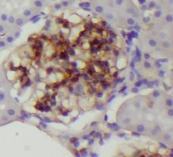 CLDN5 Rabbit Polyclonal Antibody
