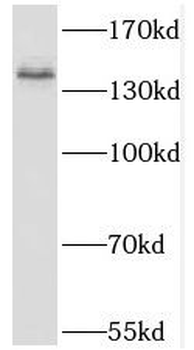 KIT Rabbit Polyclonal Antibody