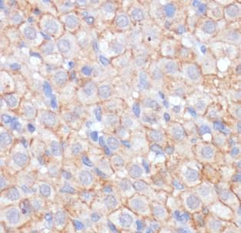 KIT Rabbit Polyclonal Antibody