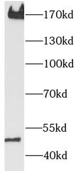 PDGFRB Rabbit Polyclonal Antibody