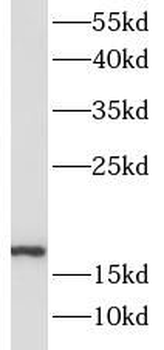 SOD1 Rabbit Polyclonal Antibody
