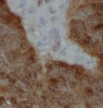 SOD1 Rabbit Polyclonal Antibody