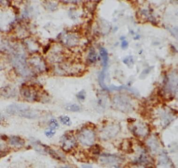 RHD Rabbit Polyclonal Antibody