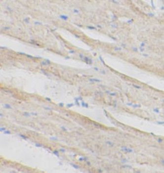 CASP3 Rabbit Polyclonal Antibody