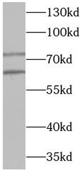 YY1 Rabbit Polyclonal Antibody