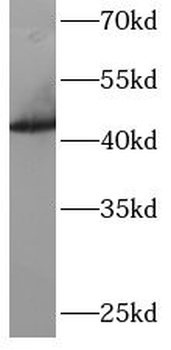 ARFGAP1 Antibody
