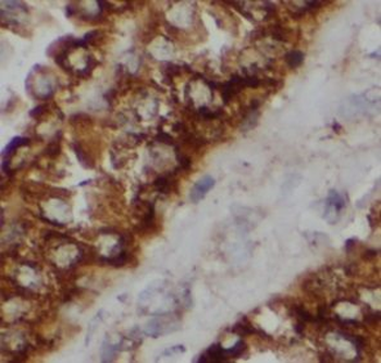 ATP5PD Rabbit Polyclonal Antibody