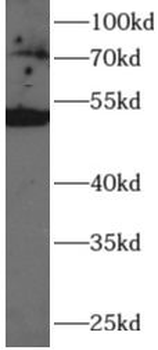 HAS3 Antibody