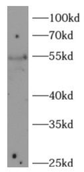 KLF4 Rabbit Polyclonal Antibody