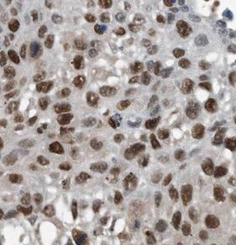 SMARCA4 Rabbit Polyclonal Antibody