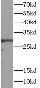 DDIT3 Rabbit Polyclonal Antibody