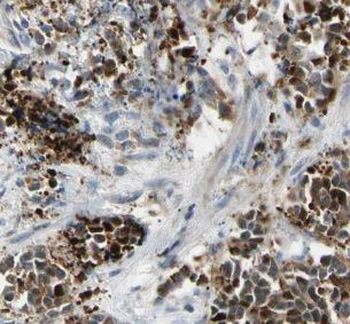DDIT3 Rabbit Polyclonal Antibody