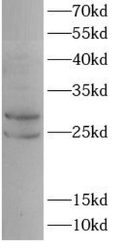 PMP22 Antibody