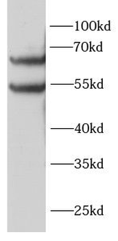 SRC Rabbit Polyclonal Antibody