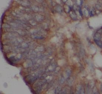 SRC Rabbit Polyclonal Antibody