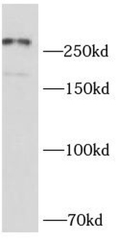 NCOR2 Rabbit Polyclonal Antibody