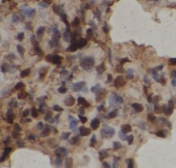 NCOR2 Rabbit Polyclonal Antibody
