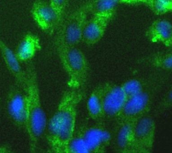MAP2K4 Rabbit Polyclonal Antibody