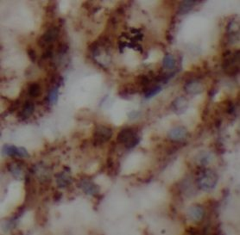 P2RX7 Antibody