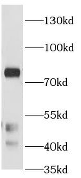 PRKCA Rabbit Polyclonal Antibody
