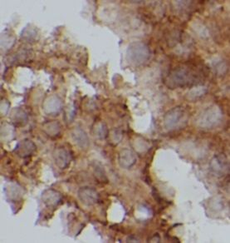 PRKCA Rabbit Polyclonal Antibody