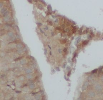UTRN Antibody