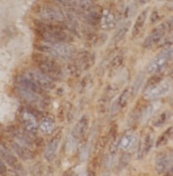GLI3 Antibody